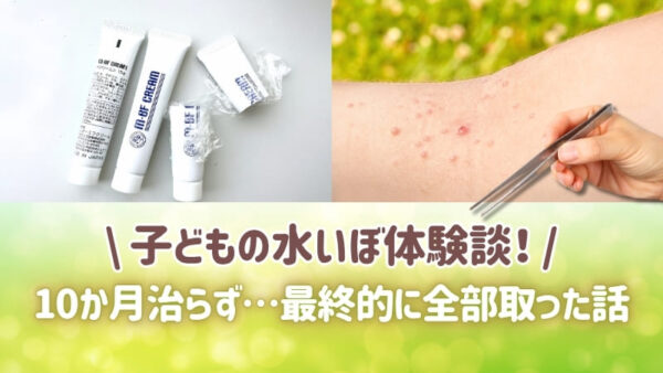 子どもの水いぼ体験談 10か月治らず最終的に全部取った話